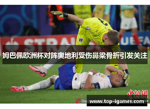 姆巴佩欧洲杯对阵奥地利受伤鼻梁骨折引发关注 姆巴佩欧洲杯对阵奥地利受伤鼻梁骨折引发关注